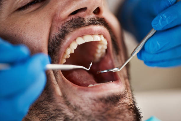Best Emergency Treatment for Jaw Pain or Injury in Phoenix Lake, CA